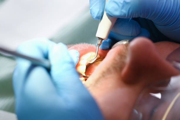 Best Emergency Broken Tooth Repair in Columbus, MN